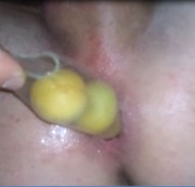 Bocken22 - Wieviel Baby-Aprikosen passen in mein Arschloch rein