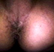 DeepPainTattoo - Meine Arschfotze 3 mit Spekulum