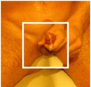 Giftpilz75 - 20cm Morgendruck abgewixxt