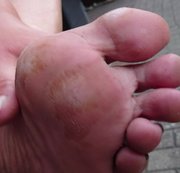 Hot-Pussy66 – Outdoor Fußpflege 1 ** Linker Fuss **