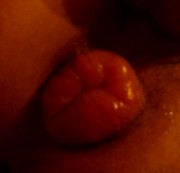 Jwill82 - arschfötzchen aufgepumpt