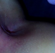 Malnic - Leck mich am Arsch