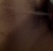 Malnic - Voll auf den Bauch gespritzt