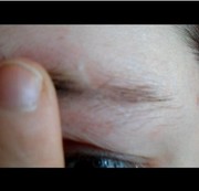 MissJen – Miss shows her scars