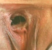 Peteshiddencamera - Franzi´s feuchte löcher gestopft