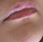 Rubensdiamant - Lippen