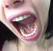 RussianBeauty – Tour of my mouth with white veneers and Big yawns! russian and english language!