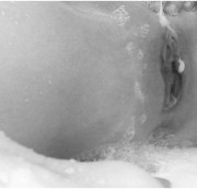 Sex-Therapie - schau dir das mal an ..