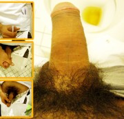 SkaterboysocksXL - Krankenhaus Natursekt und Sperma Action !