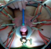 Wildcat25 - fotze EXTREM