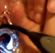 Xochil - Doktorspielchen