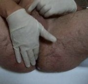 anda224 - in latexhandschuhen