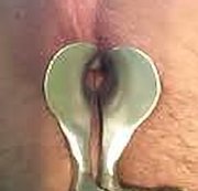hans666666666666 - Anal Speculum