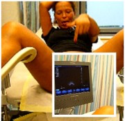 herrinsamira - Auf´m Gynstuhl im Krankenhaus...Schwanger???