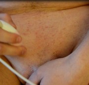 mafelder – Sack Epilation