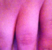 mannsluder - erste anal erfahrung