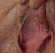 silmar00 - Geiler Strahl