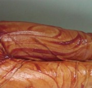 silmar00 - Mit Alles Ketchup oder was?