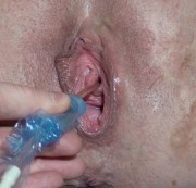 spritzigefee – Katheter Pisserei in Nahaufnahme