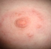 stripperella - möpse