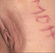 suesserachelle - Leck meine MDH muschi ganz nah!!!!